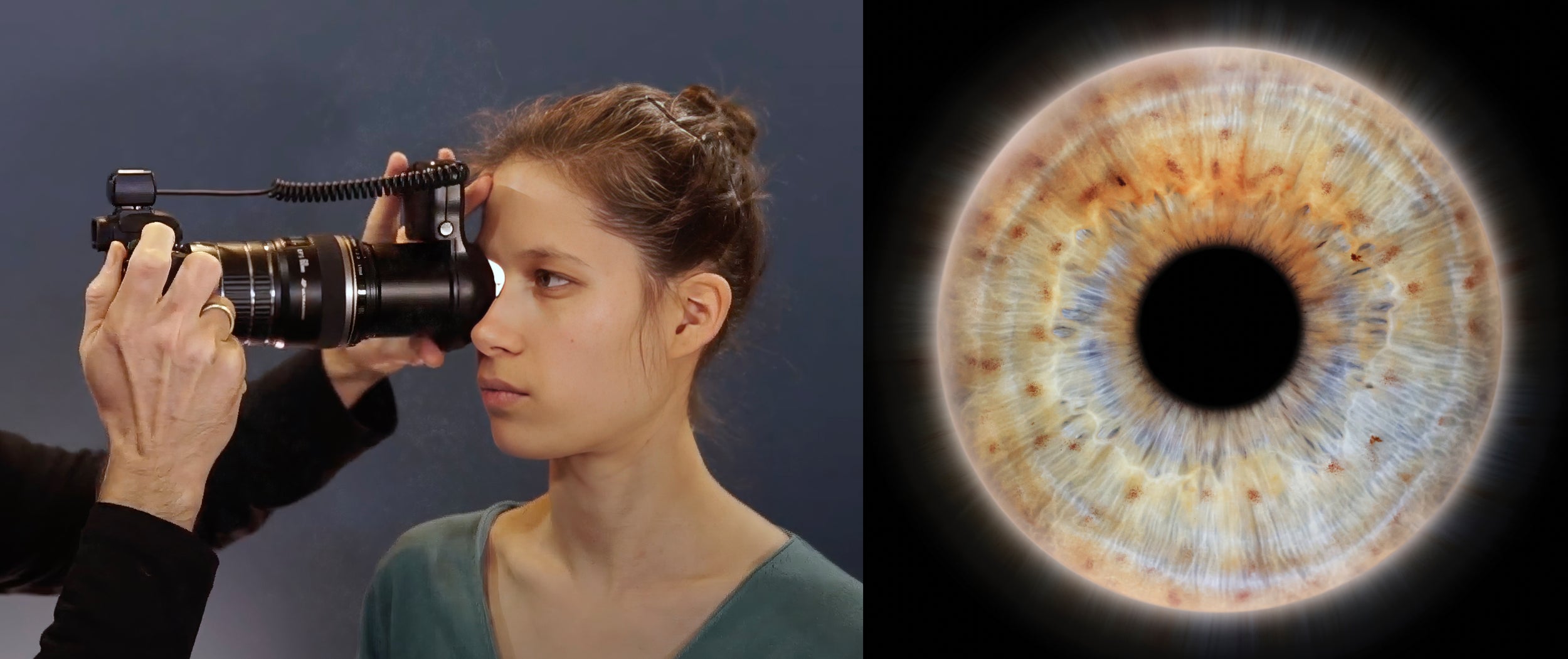 IrisLab — Professional Iriscopes & Iris Mapping Software | Est. 2004