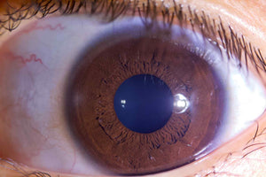 Iriscope I60 v5.1 - IRISLAB