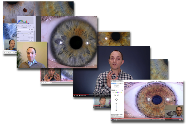 Advanced Iridology Course - IRISLAB