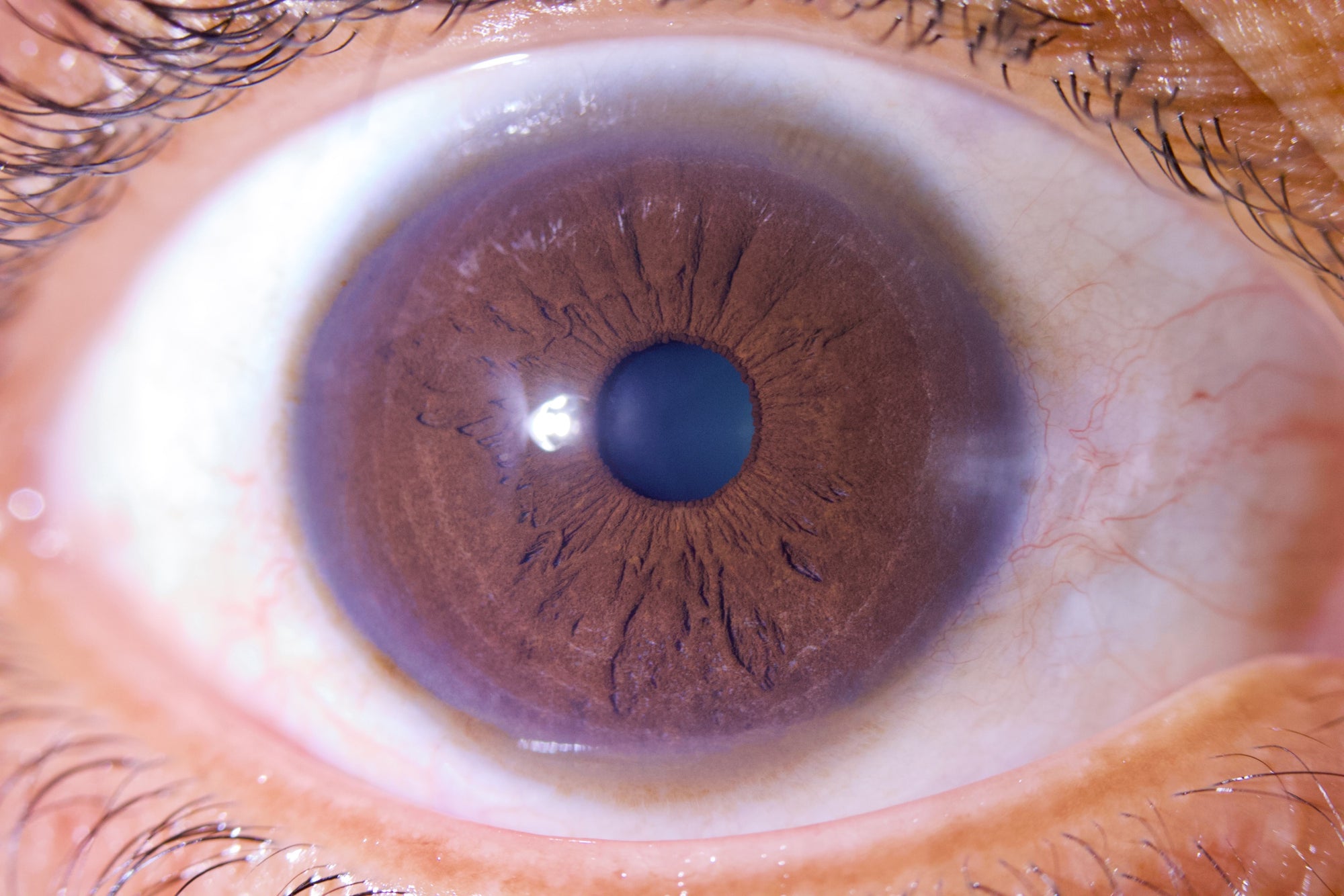 New Iriscope I60 v5 - IRISLAB