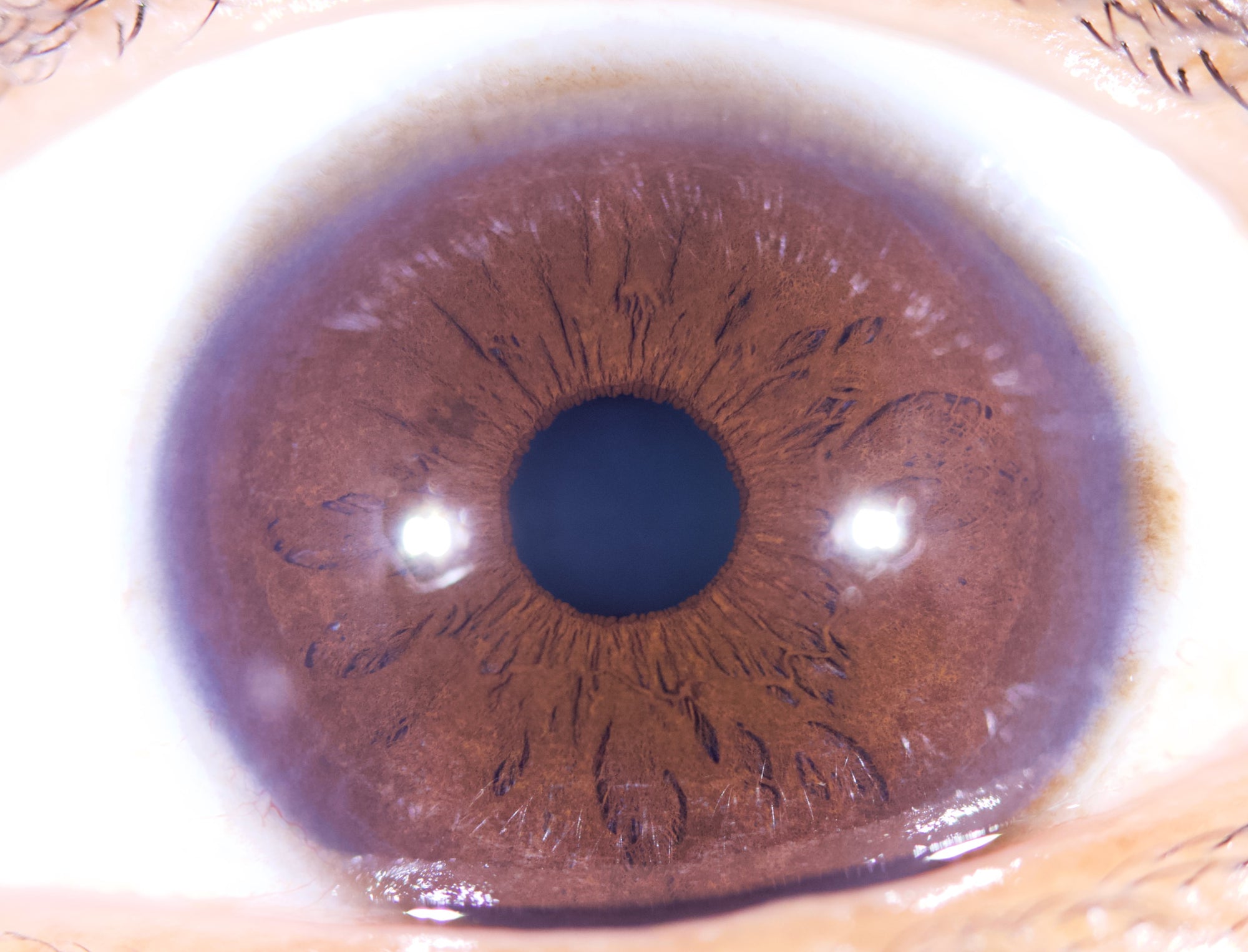 New Iriscope I60 v5 - IRISLAB
