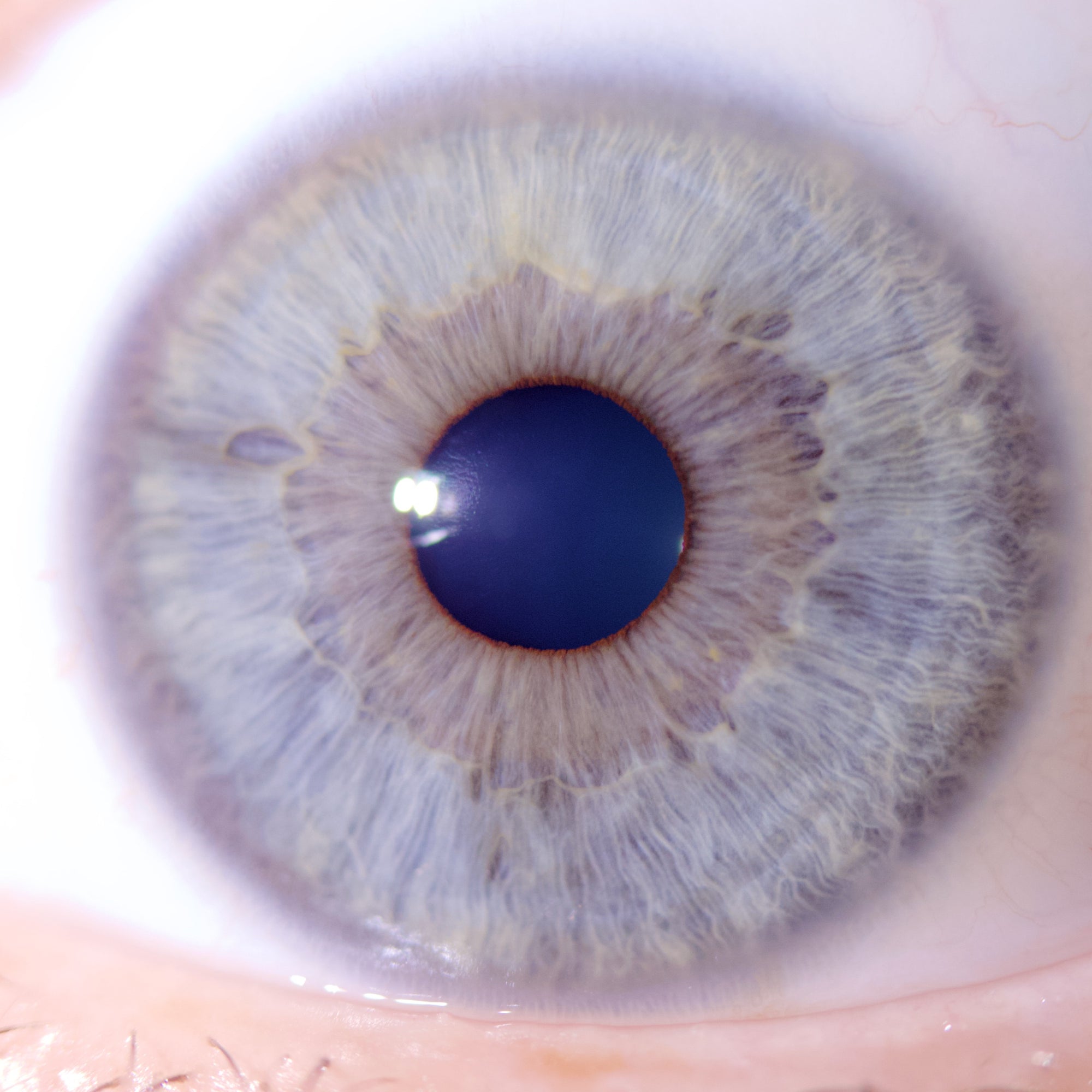 New Iriscope I60 v5 - IRISLAB