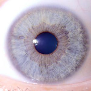 New Iriscope I60 v5 - IRISLAB