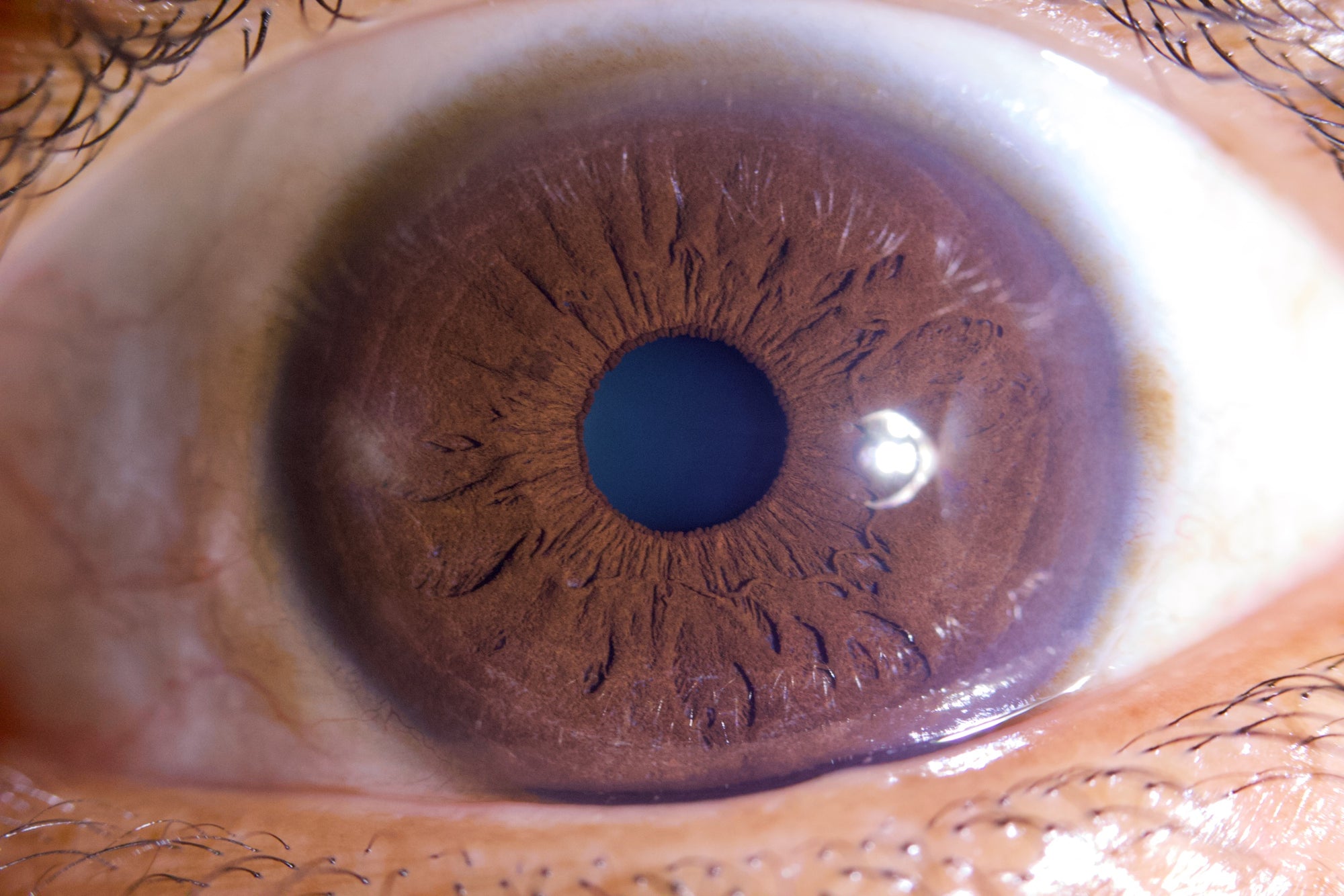 New Iriscope I60 v5 - IRISLAB
