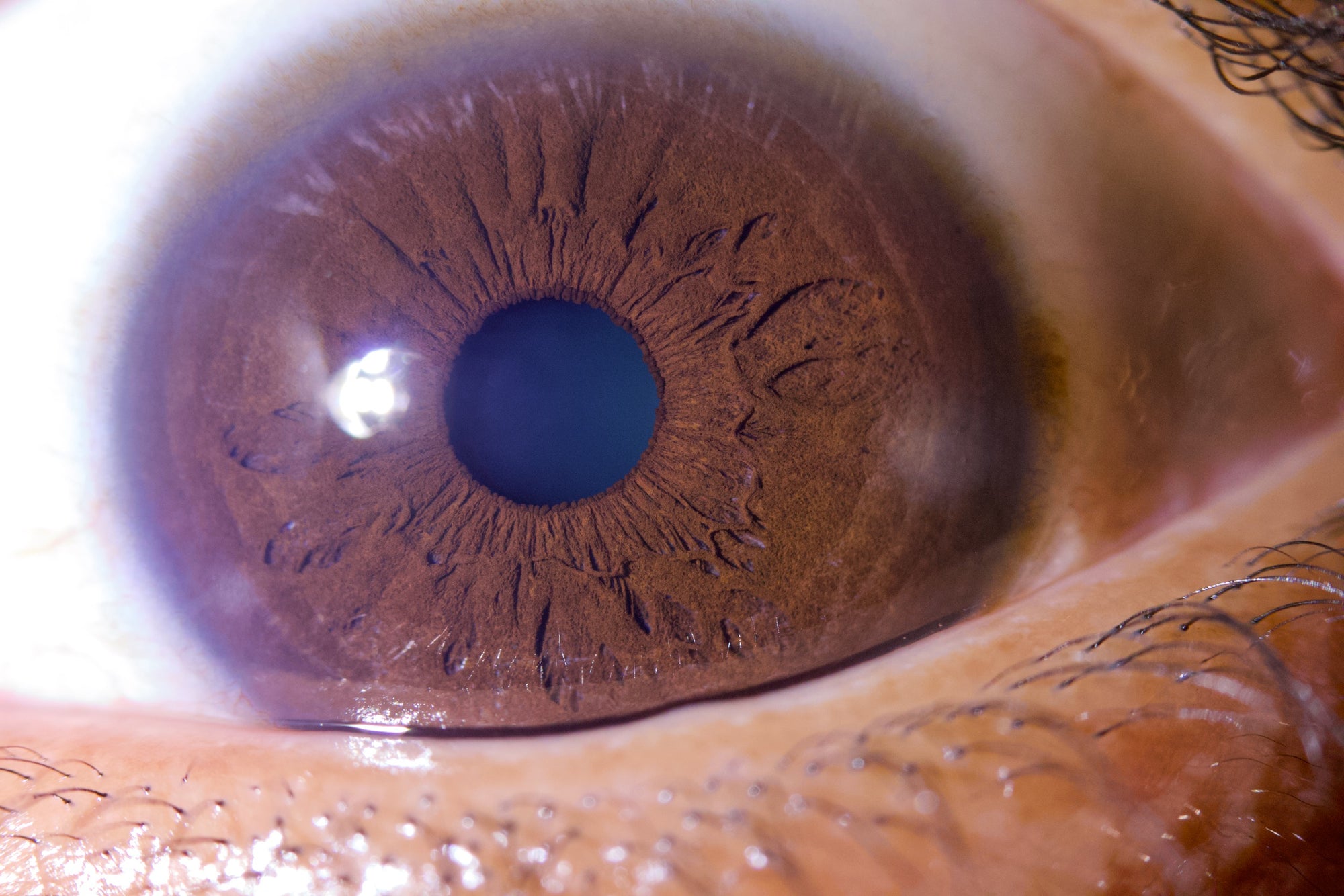 New Iriscope I60 v5 - IRISLAB