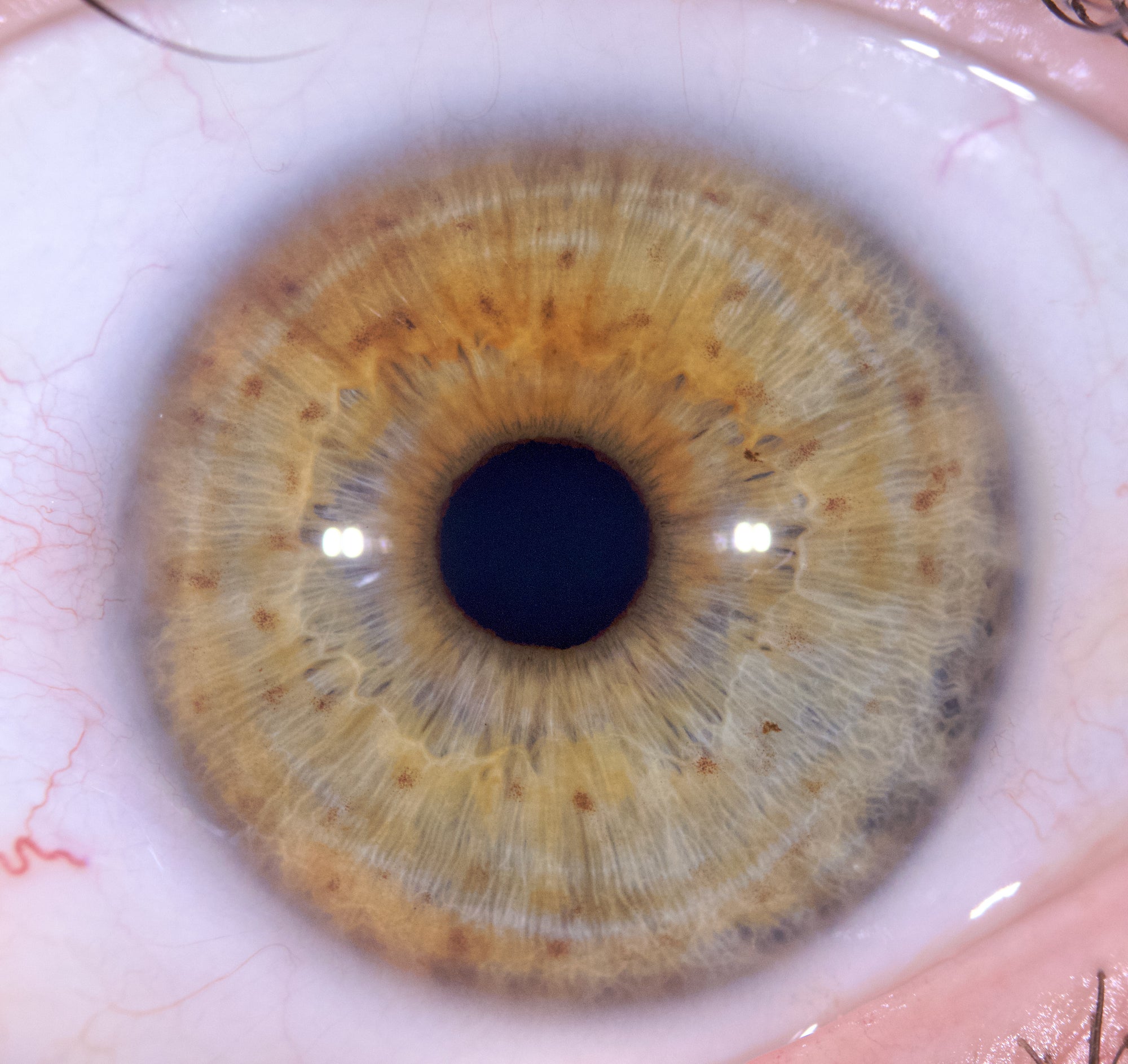 New Iriscope I60 v5 - IRISLAB