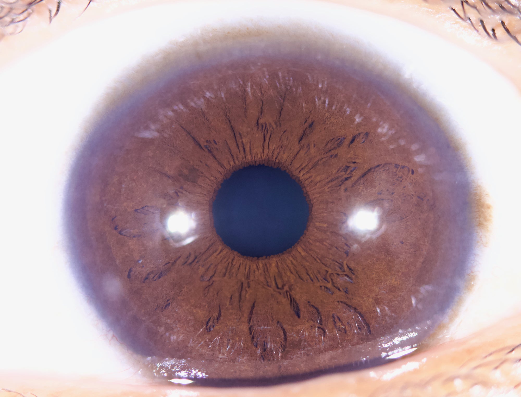 New Iriscope I60 v5 - IRISLAB