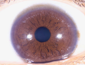 New Iriscope I60 v5 - IRISLAB