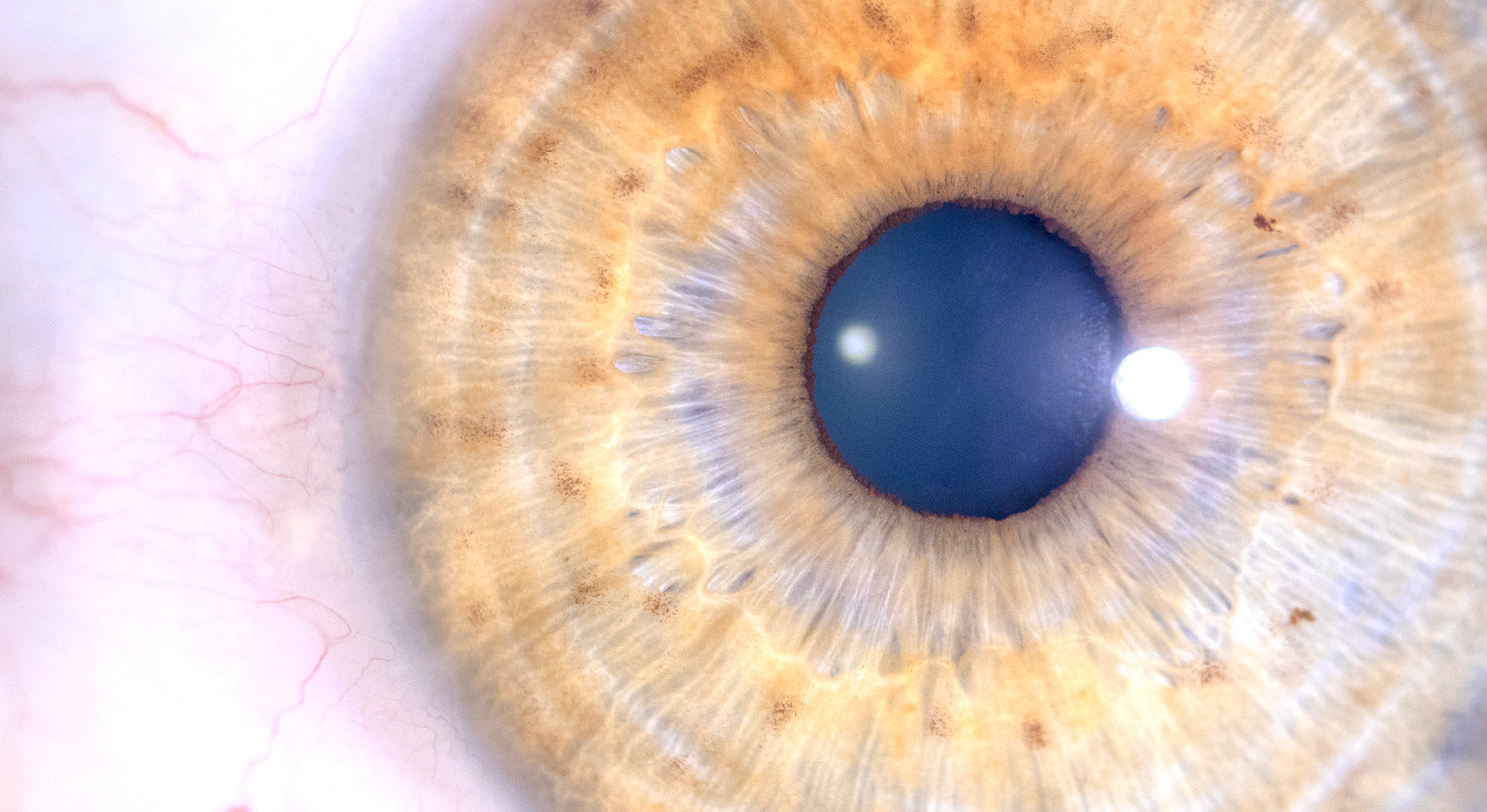 Advanced Iriscope Skills - IRISLAB