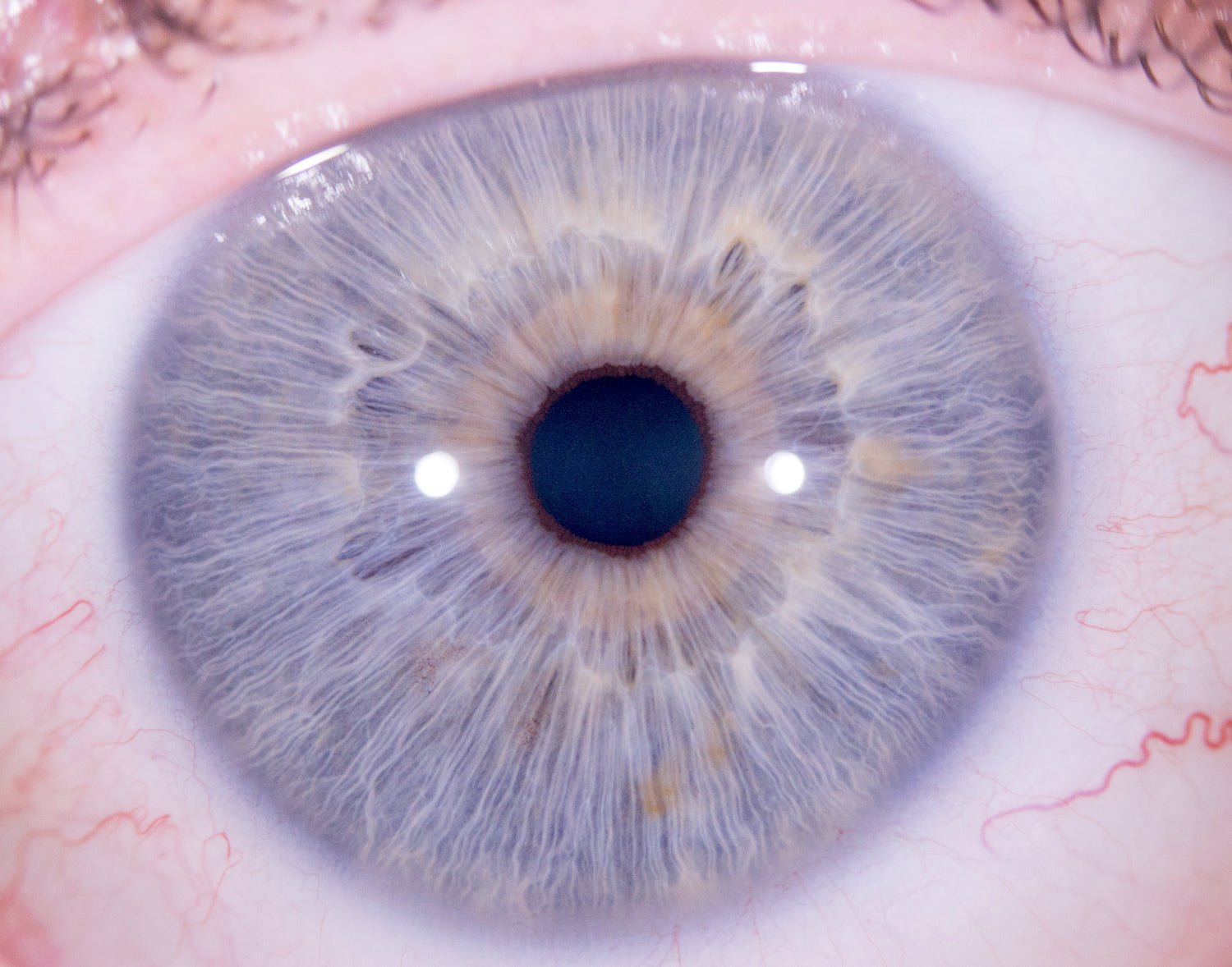 Advanced Iriscope Skills - IRISLAB